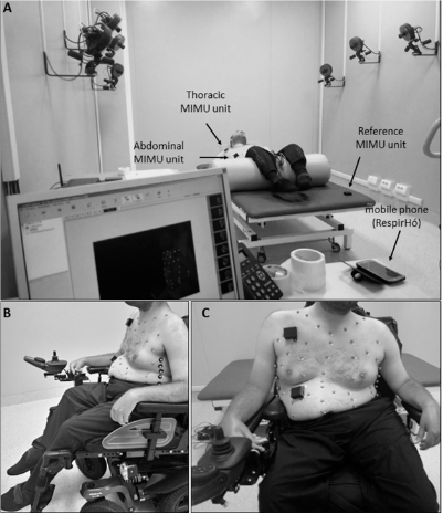 A Wearable Device for Breathing Frequency Monitoring: A Pilot Study on Patients with Muscular Dystrophy